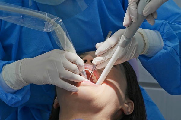 How Often Should You Get A Deep Teeth Cleaning?