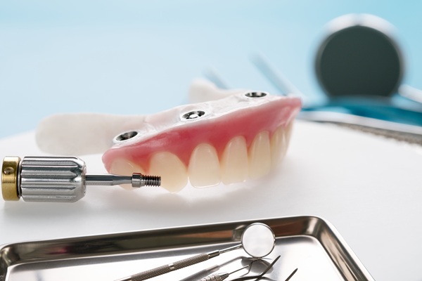 Healing Tips For Implant Supported Dentures