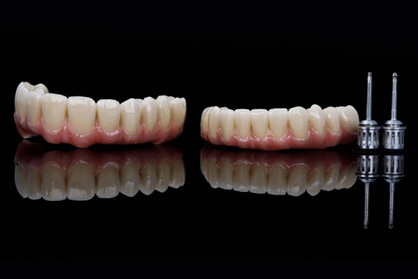 Major Benefits Of Implant Supported Dentures Over Traditional Options